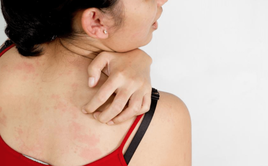 How Fast Do Bed Bugs Spread? How They Travel & Multiply (15+ Facts)