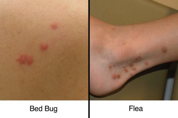 do flea bites look like pimples on dogs