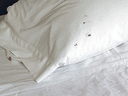 Blood Specks on Pillow Case